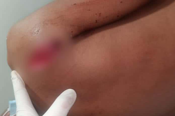 Foto luka korban